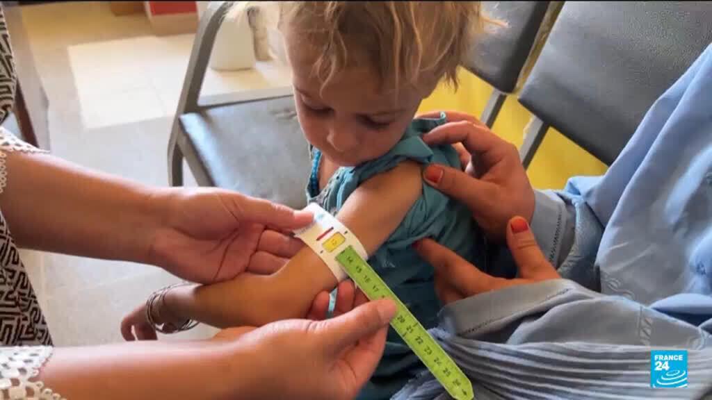 الملايين من الأطفال الأفغان يعانون من سوء التغذية الخطير
